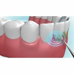 Promo ✨ Mediashop DentaPic Sonic - Hydropulseur 🔔 5 Promo ✨ Mediashop DentaPic Sonic - Hydropulseur 🔔 -Oral-B Shop unnamed file 56